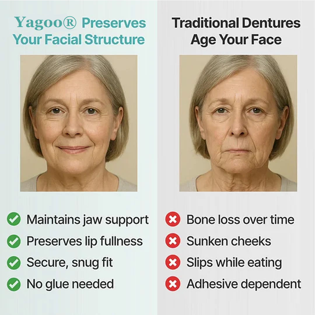 🦷Ends Today: 70% OFF! Yagoo®™ Custom-Fit Full Functional DenturesMake you more confident