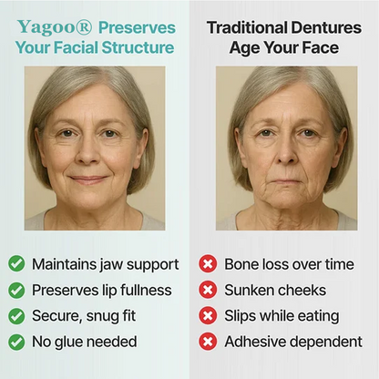 🦷Ends Today: 70% OFF! Yagoo®™ Custom-Fit Full Functional DenturesMake you more confident