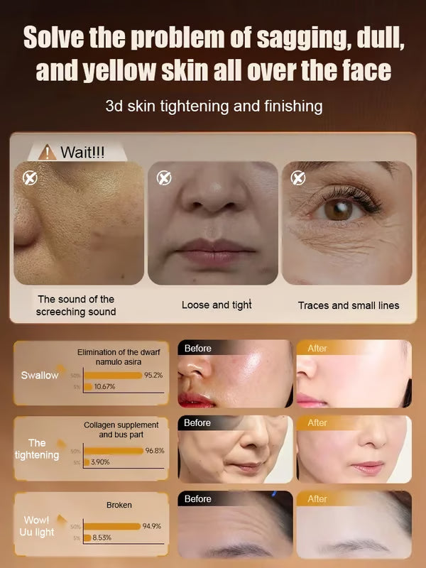 ✨Instant Wrinkle Eraser — Lingzhi Rejuvenating Spray 💦 1-Second Youth Reset!✨